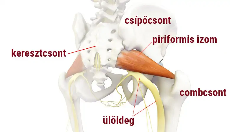 piriformis szindráma okai kezelése