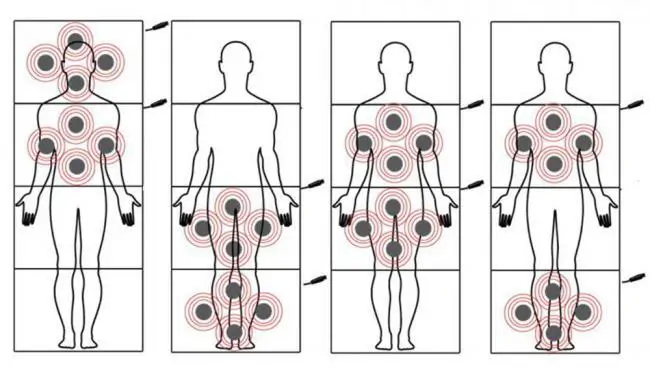 mágnesterápiás matrac Totalbody 200 mágnesterápia